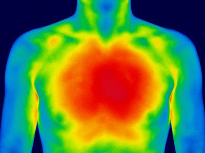 Thermal Imaging Solutions